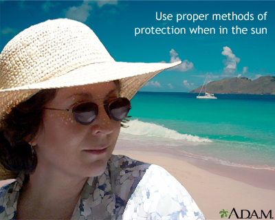 Sun protection Sun protection