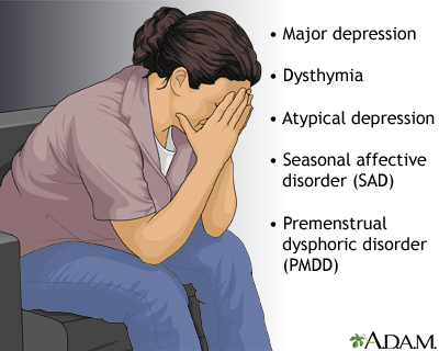 Forms of depression Forms of depression