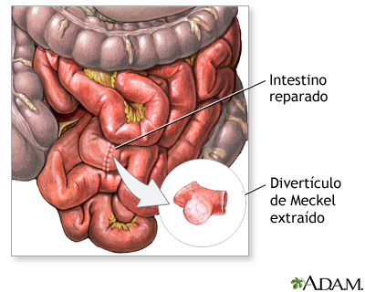 Procedimiento Procedimiento