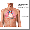 Pericardium