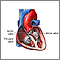 Heart valve surgery - Series