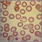 Malaria - vista microscópica de parásitos celulares