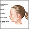 Mononucleosis infecciosa