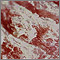 Psoriasis - magnificada por 4